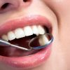 Gum Infection; A serious teeth killer