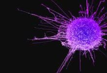 Unusual Symptoms of Cancer